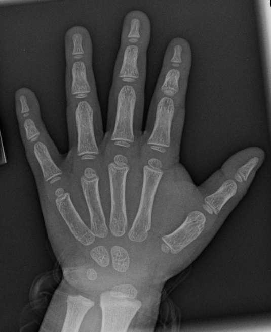 wrist bones xray